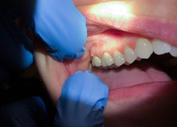 Professional Emergency Dental Service in TX